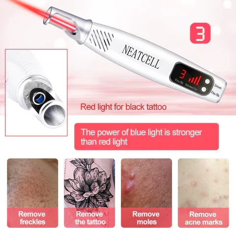 Precision laser pen for targeted removal of tattoos, moles, and freckles for clear skin.