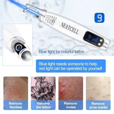 Multi-functional at-home laser pen for safe, effective tattoo, mole, and freckle removal.