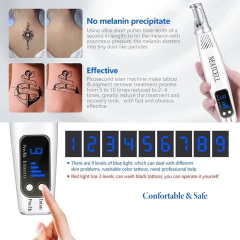 Person holding an at-home laser pen, ready for tattoo or dark spot removal.