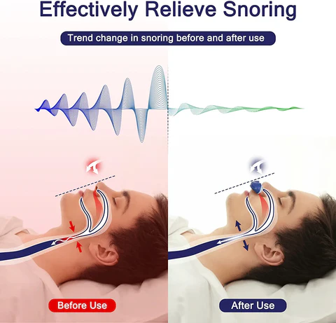 Sleek maskless nasal CPAP device for sleep apnea & snoring. Rechargeable & portable anti-snoring solution.