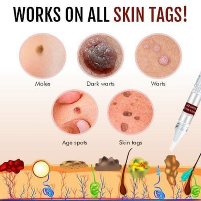 Natural Skin Tag & Mole Remover for blemish repair, featuring tea tree oil.