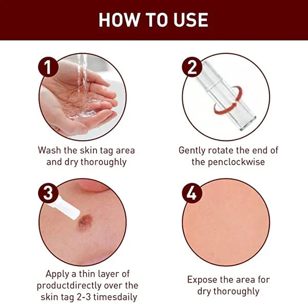 Home remedy skin tag and mole removal treatment for clear, blemish-free skin.