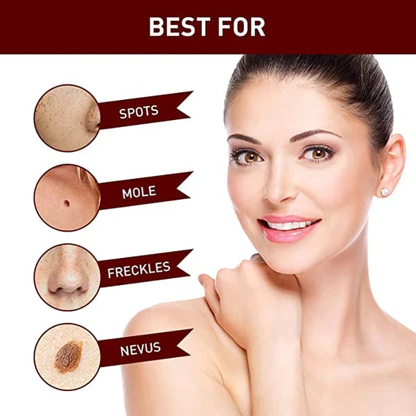 Professional-grade skin tag & mole removal solution for clear, healthy skin.