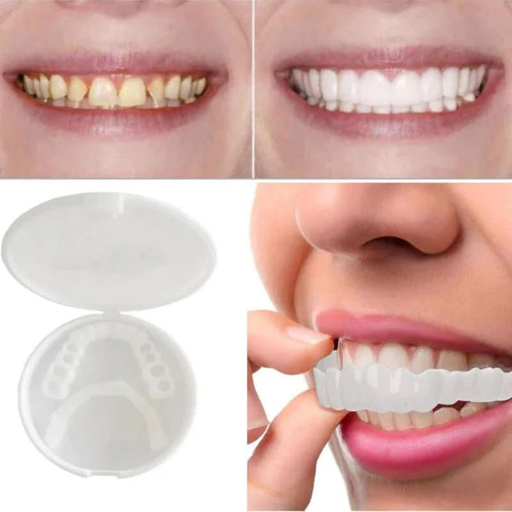 Adult beauty accessory: temporary veneers and cosmetic teeth for an instant, easy-fit confident smile and dazzling look.