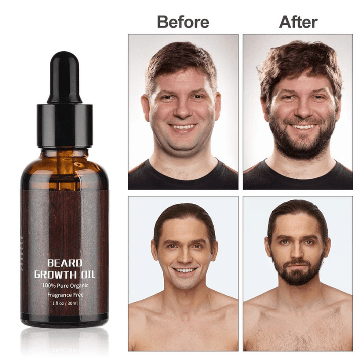 Revitalize your facial hair with this beard growth kit for men's grooming.