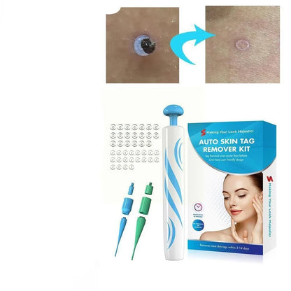 Painless auto skin tag remover kit for clear, smooth skin. Easy home treatment beauty tool for effective skin care.