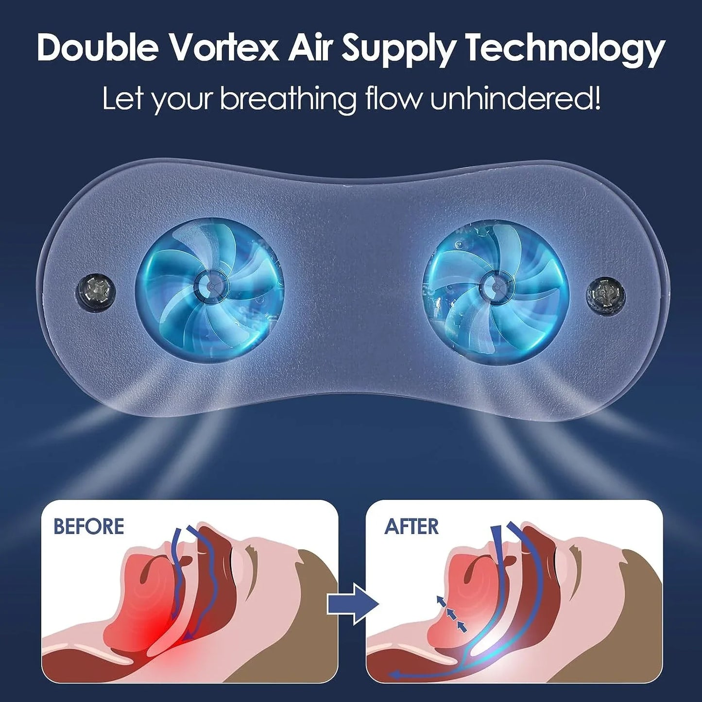 Travel-friendly micro CPAP alternative for sleep apnea. Rechargeable & compact anti-snoring aid.