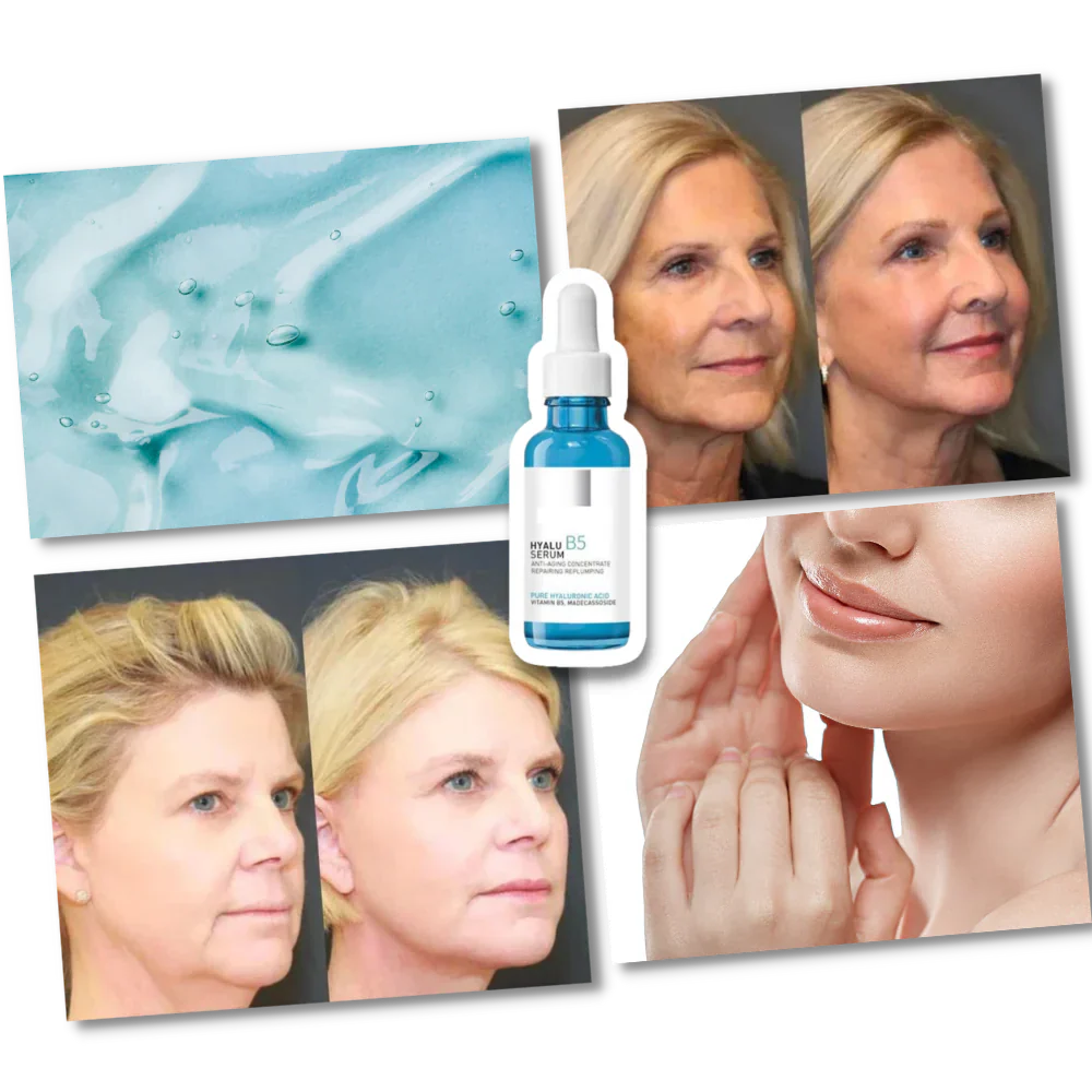 Rejuvenating Hyalu B5 Hyaluronic Acid Serum, a powerful anti-aging skincare for intense hydration.