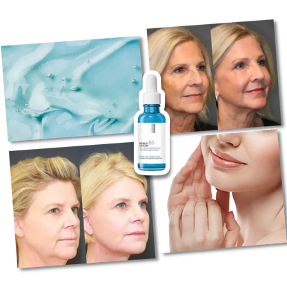 Rejuvenating Hyalu B5 Hyaluronic Acid Serum, a powerful anti-aging skincare for intense hydration.
