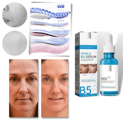 Skincare product: Hyalu B5 Hyaluronic Acid Serum for anti-aging, hydration, and brighter skin.