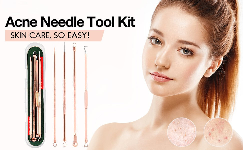 Set of professional blackhead remover & pimple extractor tools. Skincare solution for clear facial skin.