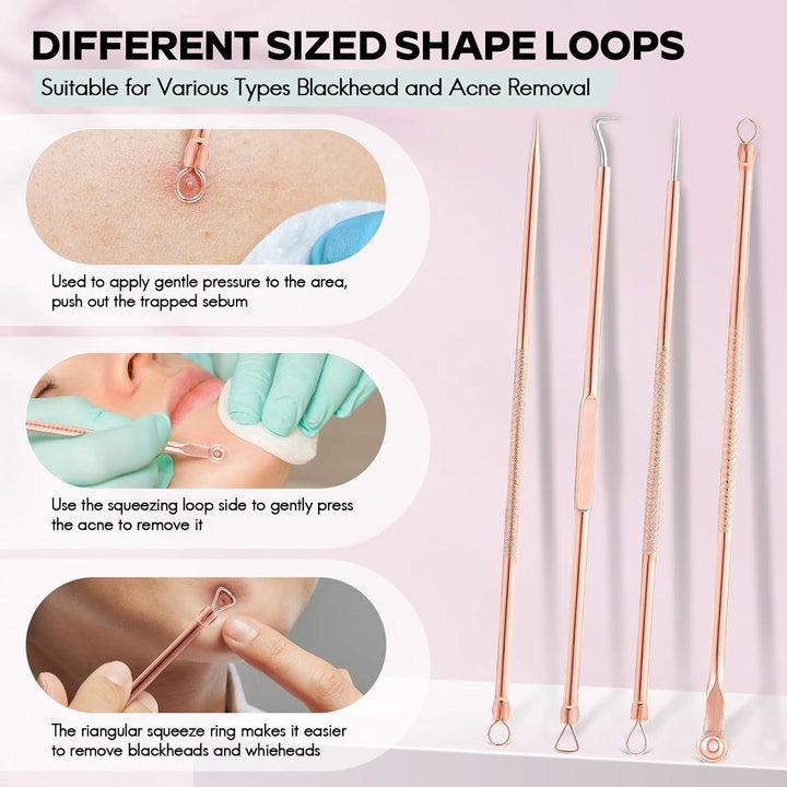Acne treatment kit: stainless steel blackhead remover and pimple extractor tools for home use.