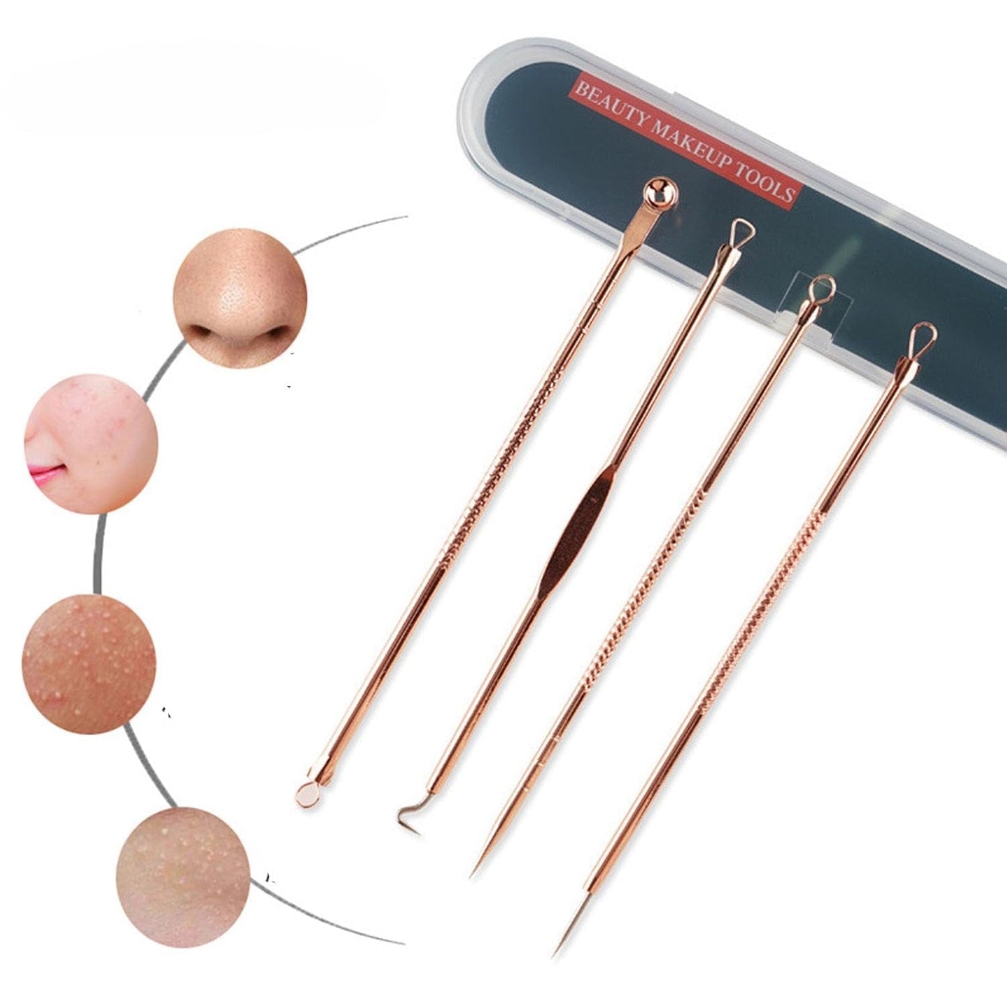 Professional blackhead remover & pimple extractor tools. Skincare kit for effective acne treatment.