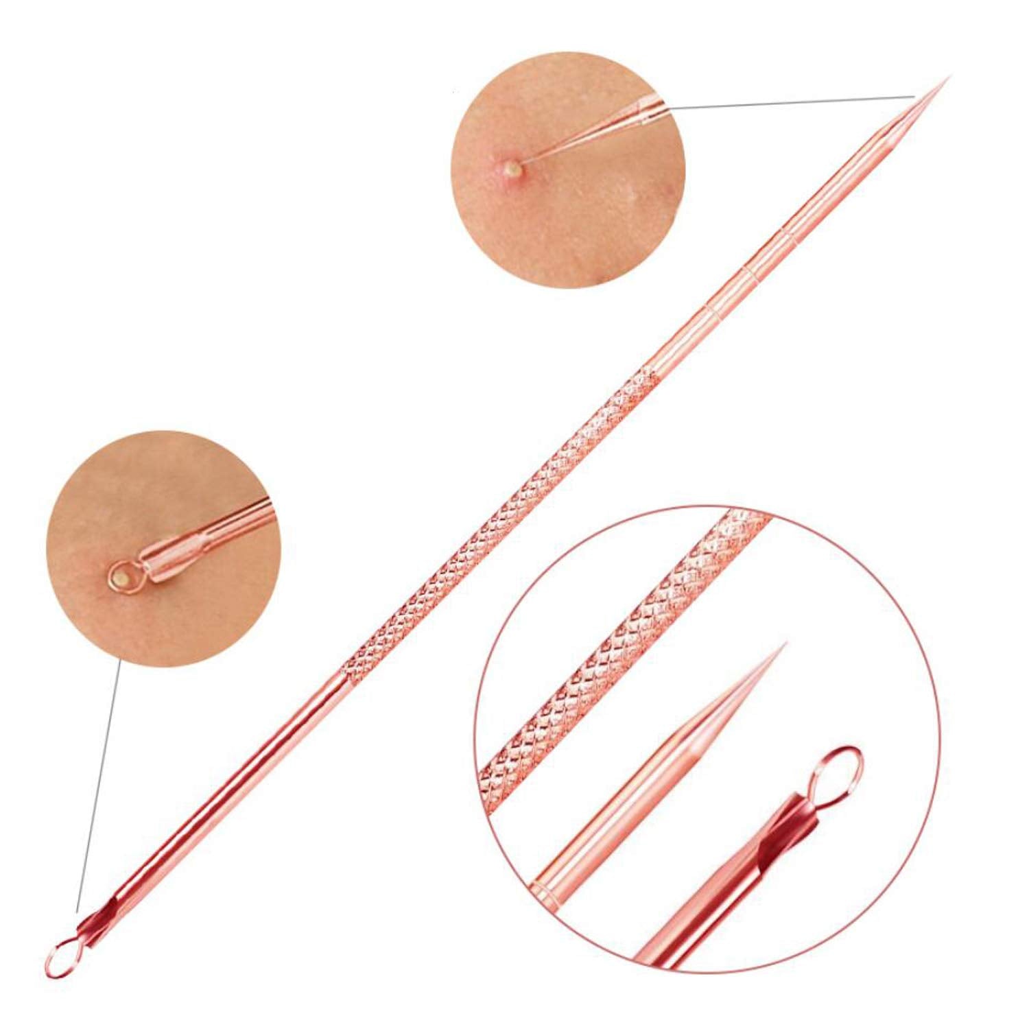 Durable stainless steel blackhead remover kit. Pimple extractor tools for precise blemish removal.