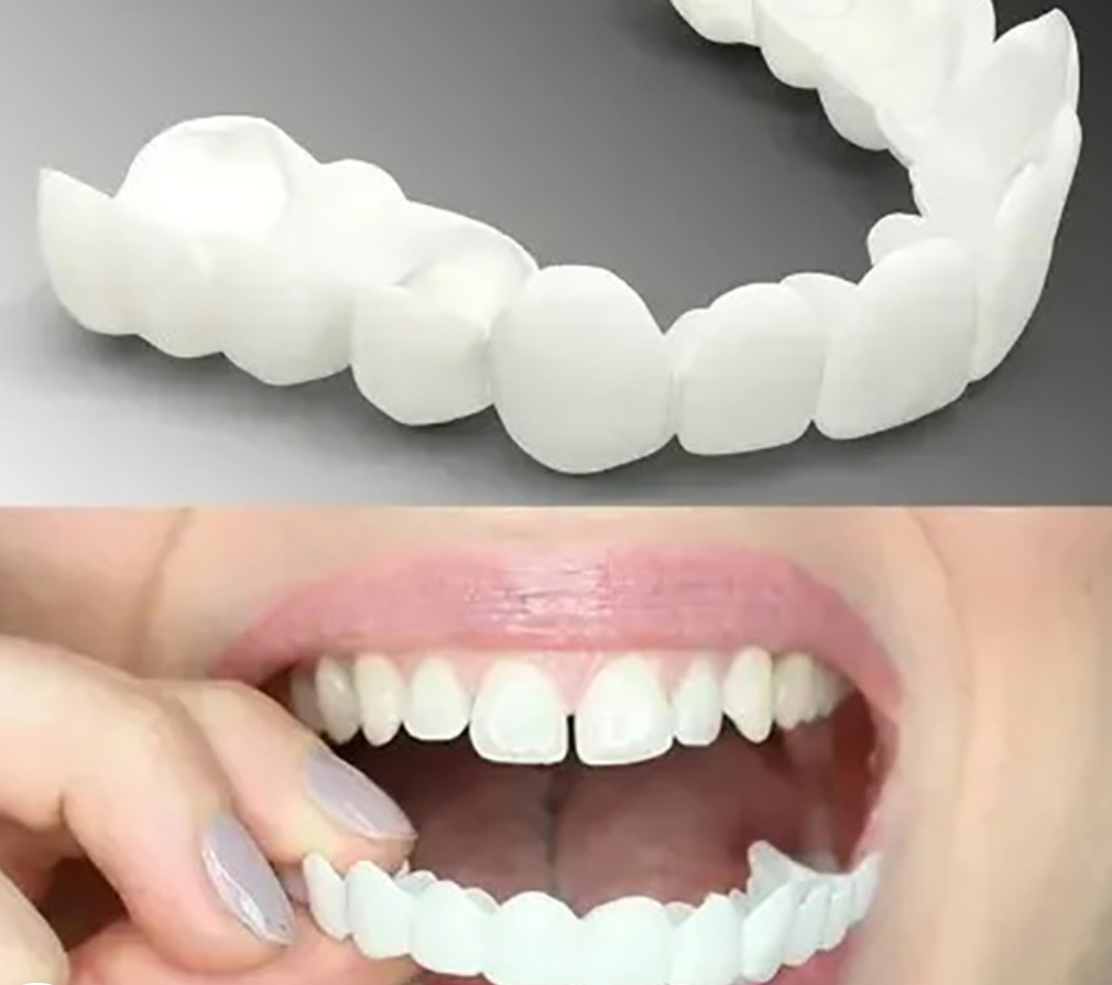 Easy-to-use snap-on dental veneers for an instant, confident smile. Adjustable temporary teeth improve oral aesthetics.