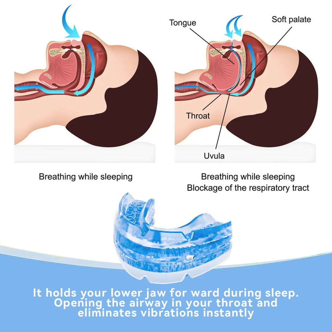Comfortable BPA-free sleep aid mouthpiece. Custom-fit anti-snore guard for improved breathing & restful sleep.