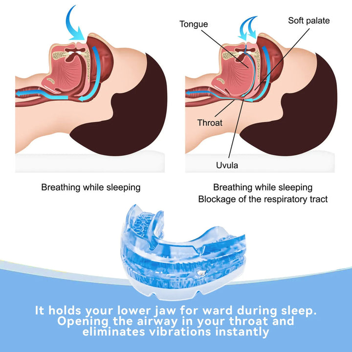 Comfortable BPA-free sleep aid mouthpiece. Custom-fit anti-snore guard for improved breathing & restful sleep.