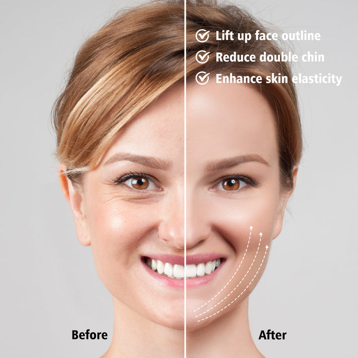 EMS facial sculptor for anti-aging, double chin removal, and improved facial contours.