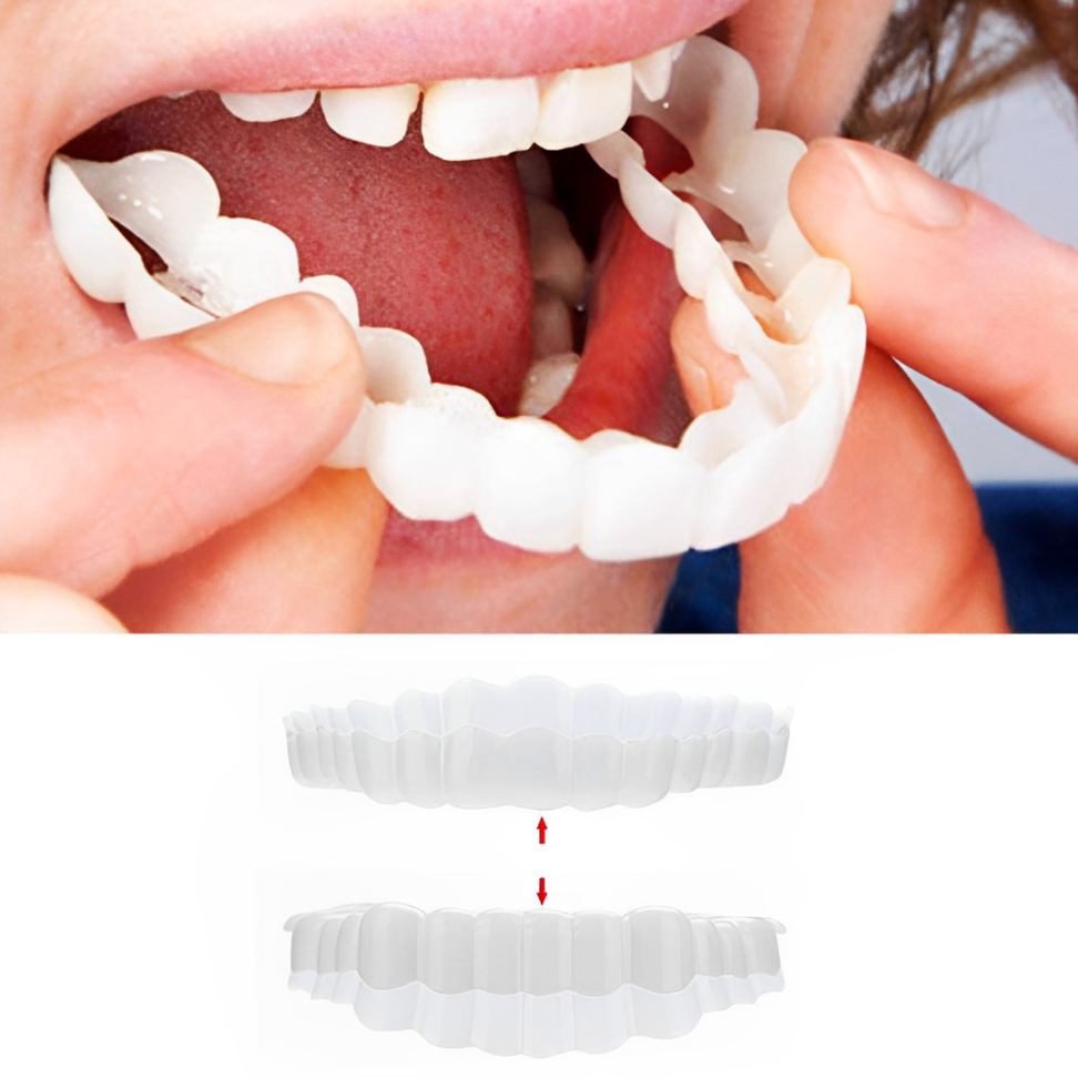 Unisex instant clip-on veneers kit for a perfect smile, upper & lower teeth covers.