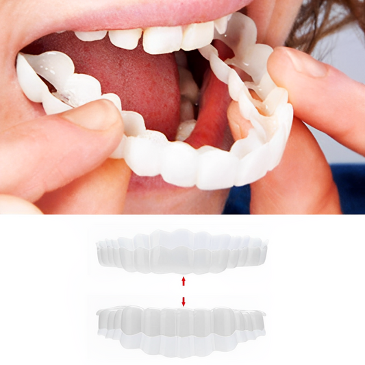 Unisex instant clip-on veneers kit for a perfect smile, upper & lower teeth covers.
