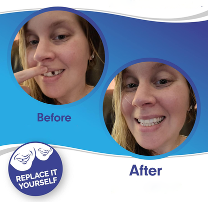 Clip-on smile veneers kit for natural-looking teeth enhancement, unisex upper & lower covers.