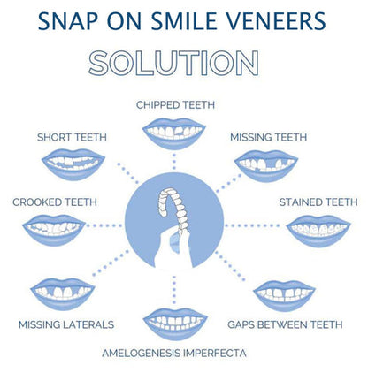 Affordable instant smile veneers for men & women, full upper & lower snap-on dental covers.