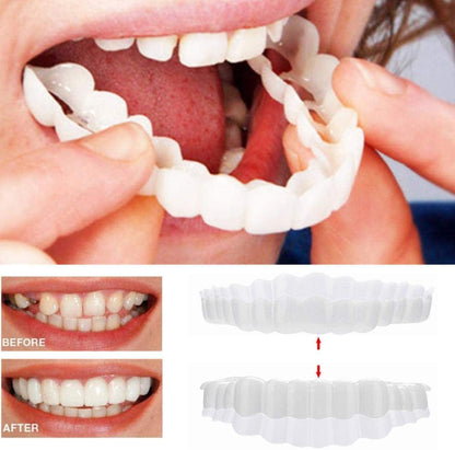 Quick fix dental beauty with unisex clip-on veneers, upper & lower instant smile enhancement kit.