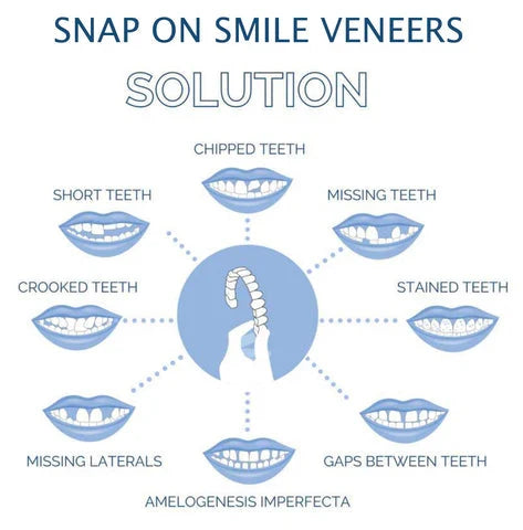 Instant smile temporary clip-on veneers. Reusable cosmetic teeth for men & women seeking a quick smile fix.
