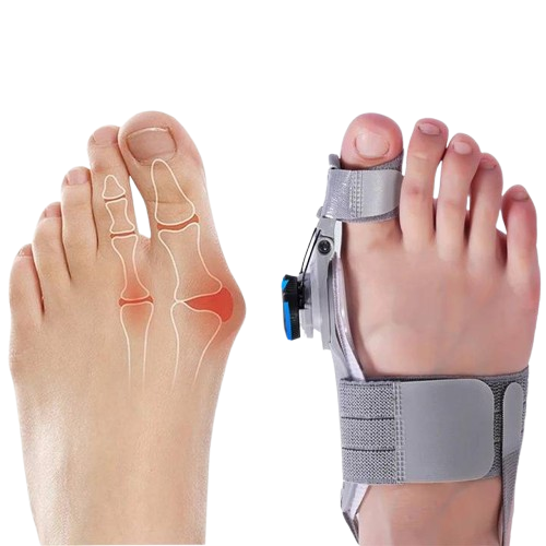 Unisex natural bunion corrector toe spacer for effective pain relief & foot alignment. Soft silicone for comfort.