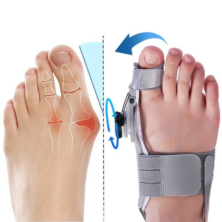 Flexible silicone bunion corrector and toe spacer providing natural foot alignment & bunion pain relief.