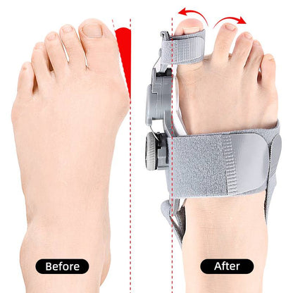 Unisex orthopedic bunion corrector with toe spacer for foot alignment. Non-surgical pain relief solution.