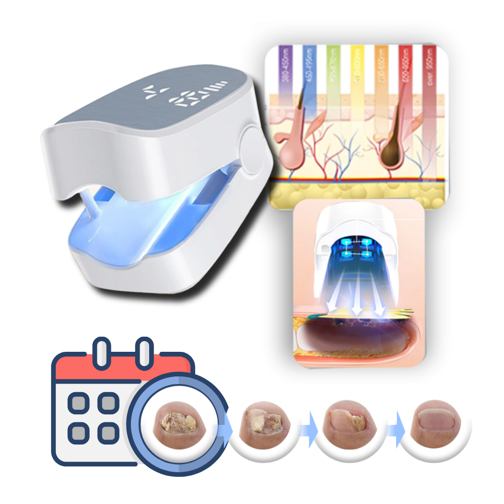 Portable laser device for effective fungal nail treatment. Painless personal care for healthy, clear fingernails & toenails.