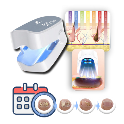 Portable laser device for effective fungal nail treatment. Painless personal care for healthy, clear fingernails & toenails.