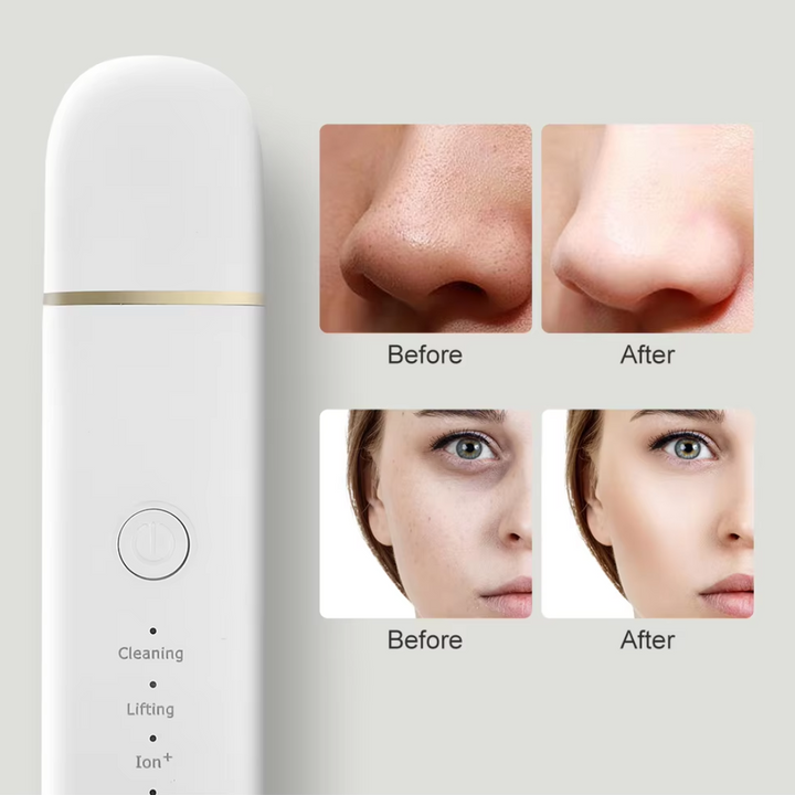 Rechargeable unisex deep cleansing ultrasonic skin scrubber for effective blackhead removal.
