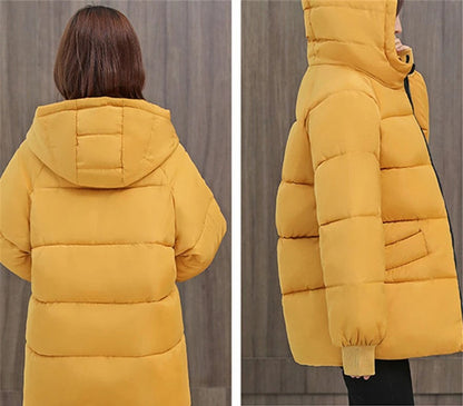 Women's oversized hooded puffer coat, providing exceptional warmth & a fashionable winter silhouette.