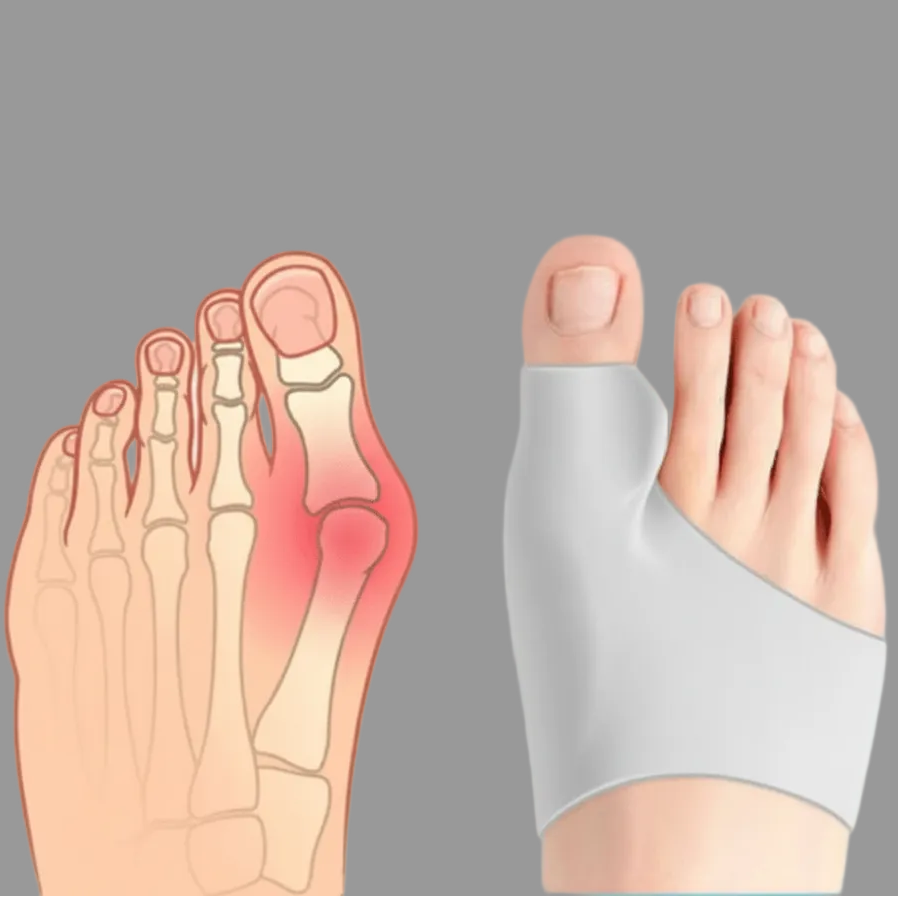 Comfortable youth bunion corrector, designed for enhanced mobility and teen foot care.