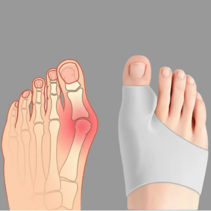 Comfortable youth bunion corrector, designed for enhanced mobility and teen foot care.